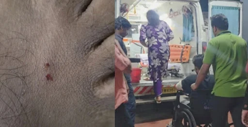 തച്ചംപൊയിൽ യുവാവിന് പാമ്പ് കടിയേറ്റു.